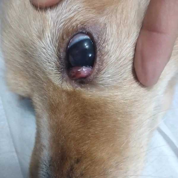 جراحی چشم و برداشت پلک سوم