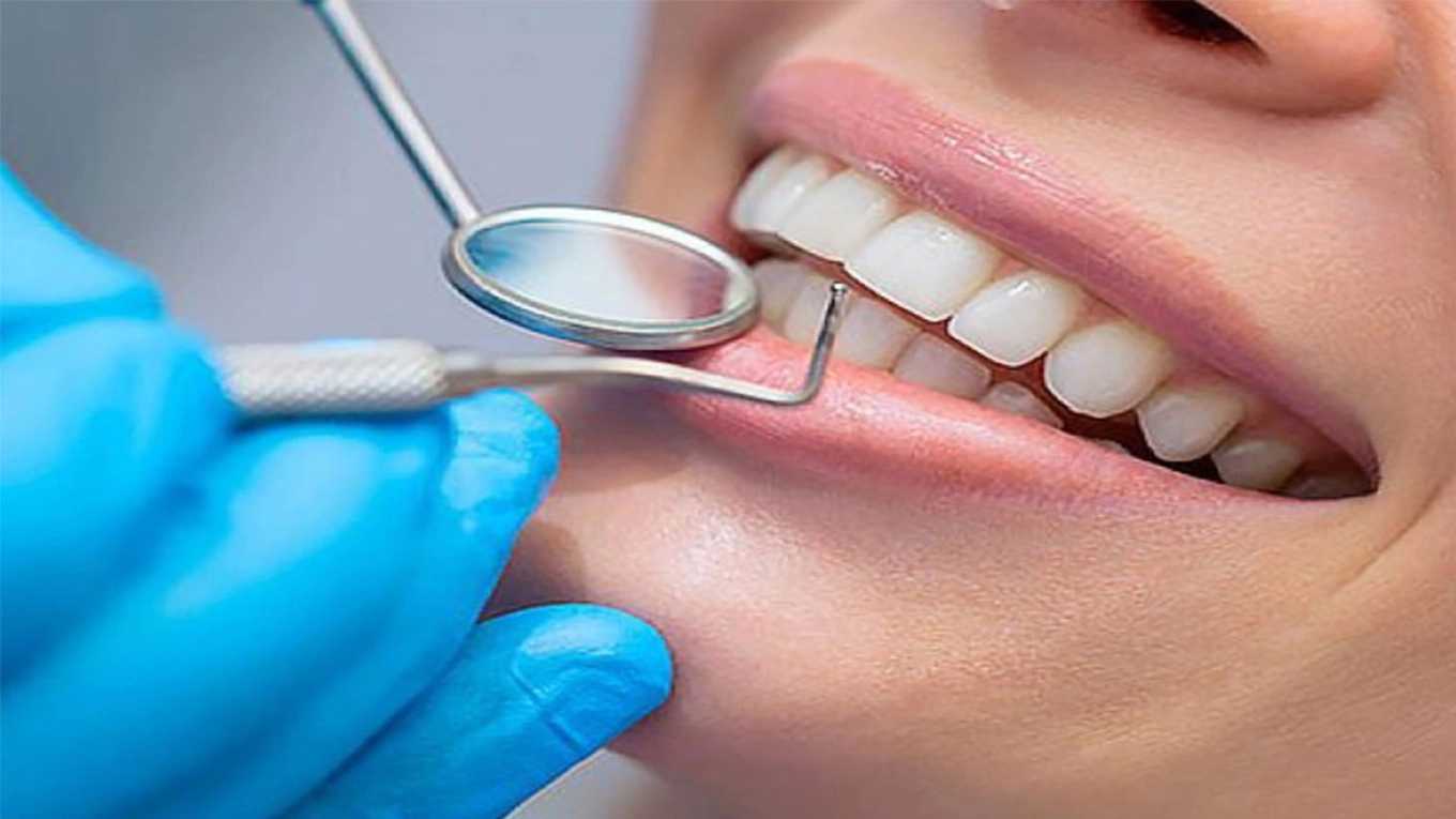 Andisheh Shahriar'da nano seramik diş hekimliği New Face One kompozitinin gerçekleştirilmesi