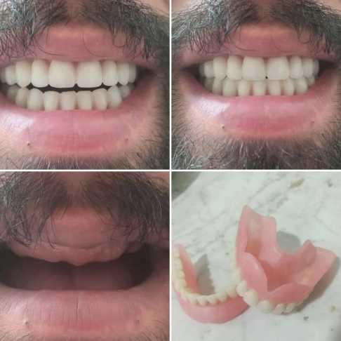 دندان مصنوعی و لابراتوار دندانسازی آرش منبری در سنندج