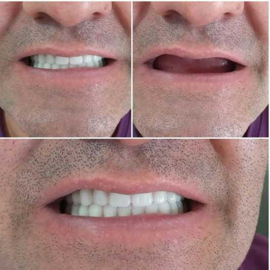 دندان مصنوعی و لابراتوار دندانسازی آرش منبری در سنندج