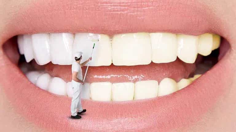 Causes of teeth discoloration