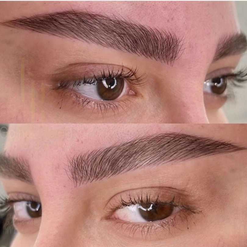 میکروبلیدینگ وتاتوحسینی
