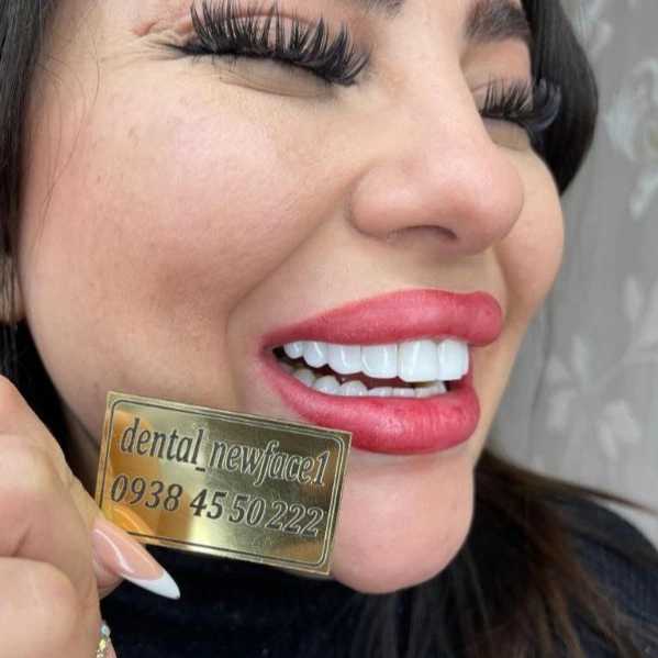 کامپوزیت نانو سرامیک دندان