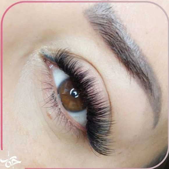 کاشت مژه