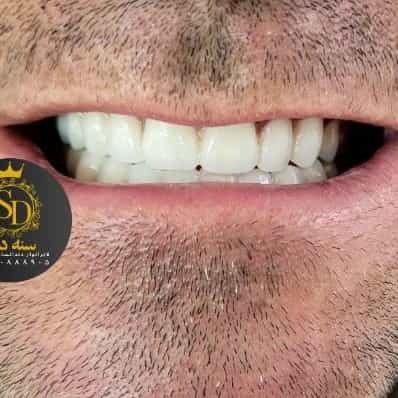 1710546822449.webp