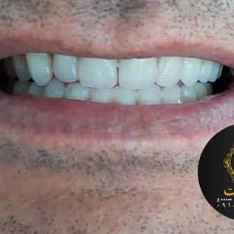 1710547015093.webp