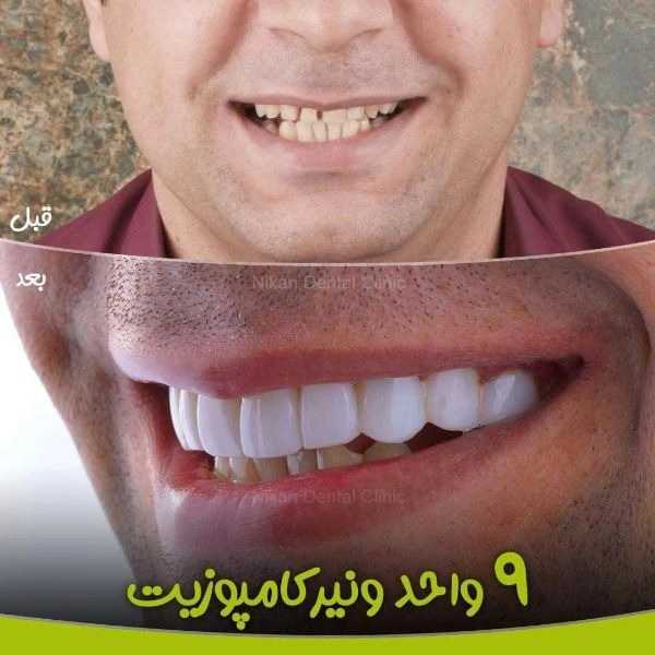دندان پزشکی نیکان