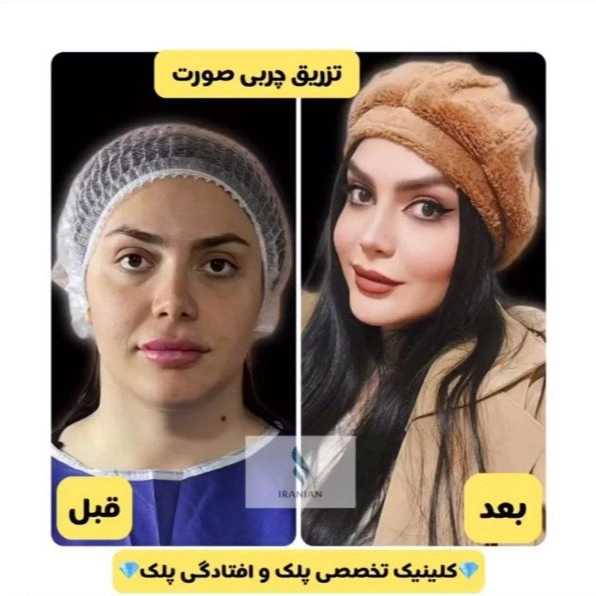 کلینیک ایرانیان