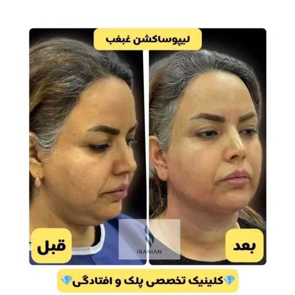 کلینیک ایرانیان