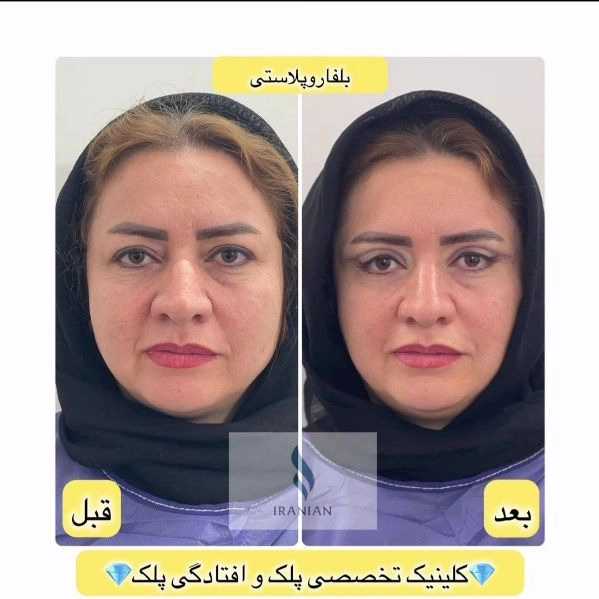 کلینیک ایرانیان