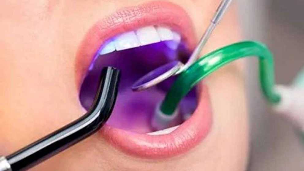 نکات مهم در نگهداری از تجهیزات دندانپزشکی