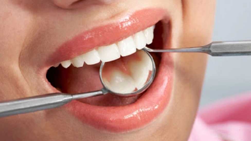 مراقبت های پس از ترمیم دندان
