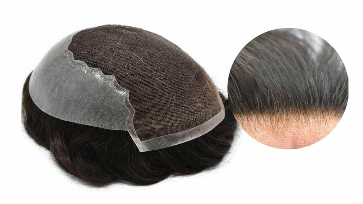 Types of hair prosthesis