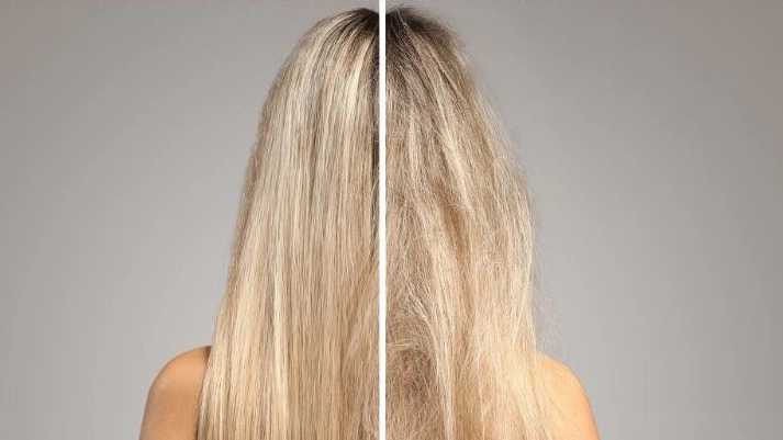 بوتاکس مو چیست؟
