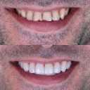 طب أسنان الدكتور أميني، زراعة الأسنان وإزالة التعصيب في الأهواز