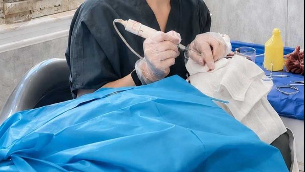 Rasht Royan Transplantation Center, specialized hair and eyebrow transplant services by micrograft method