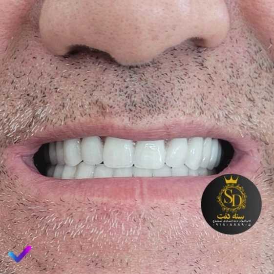 1710546883222.webp