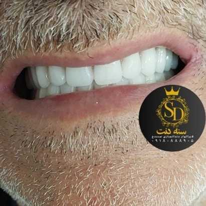 1710546986460.webp
