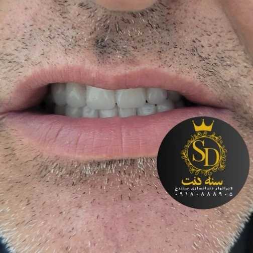 1710547072779.webp