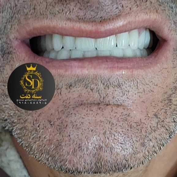 1710547265464.webp