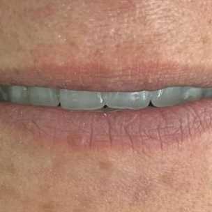 1710547643927.webp