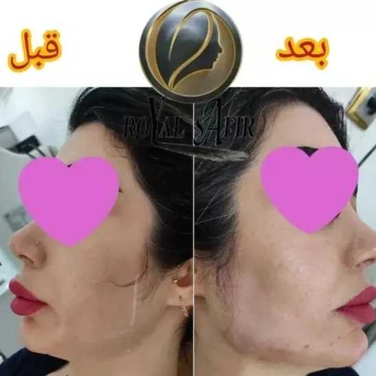 1715071858499.webp