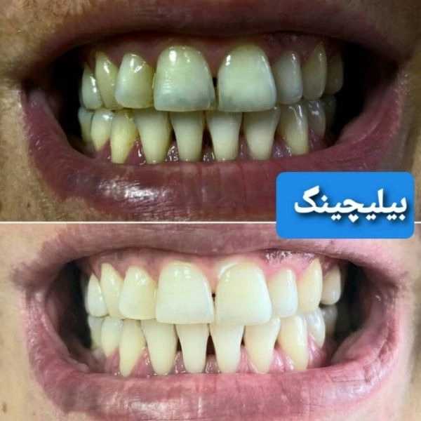 1715154946283.webp