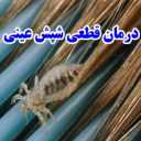 Definitive treatment of head lice in Tehran