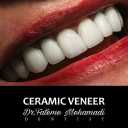 Dr. Fatemeh Mohammadi Dental Clinic, Laminate Implant in Isfahan