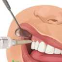 Hayan dental equipment, distribution of cartridge injection needles and gutta meta in Qom
