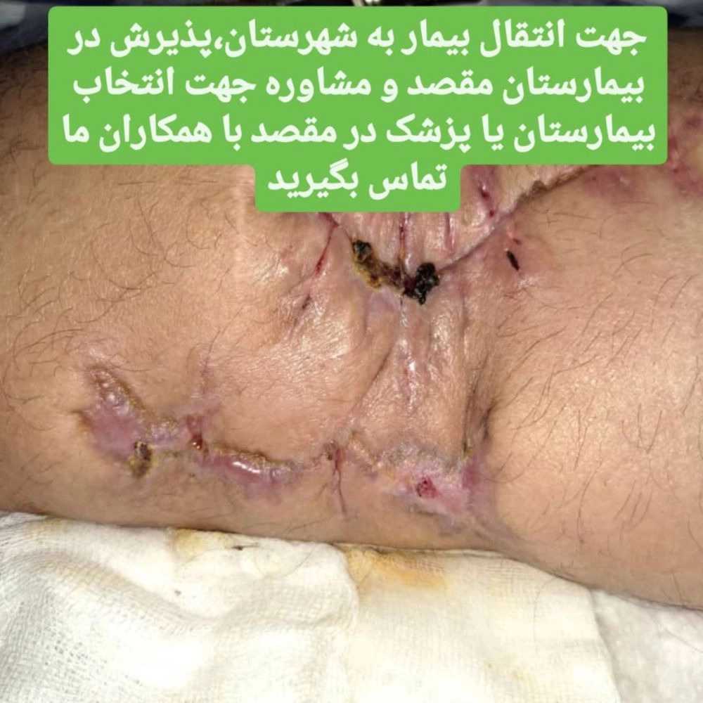 1741156868604.webp