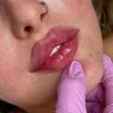 My Na Beauty Clinic, providing botox filler mesotherapy and PRP services in Kermanshah
