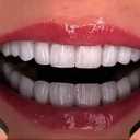Salih Rezaei dental clinic, composite and cosmetic nerve repair services in Tabriz