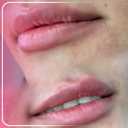 Moana beauty clinic, beauty services and botox lip fillers and rejuvenation in Sabzevar
