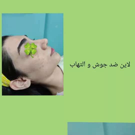 اسکین کر مریم