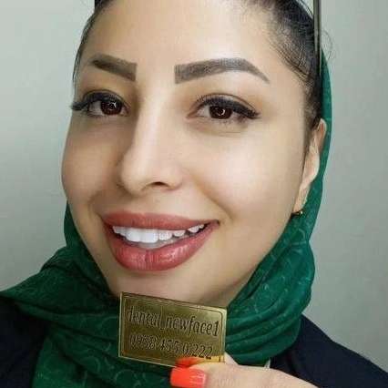 کامپوزیت نانو سرامیک دندان