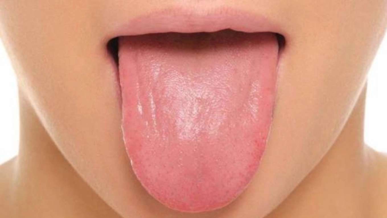 Diagnosing the disease from the tongue