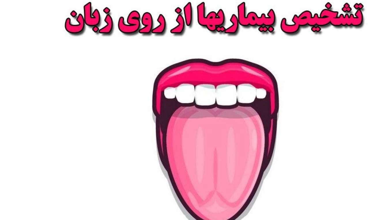 Diagnosing the disease from the tongue