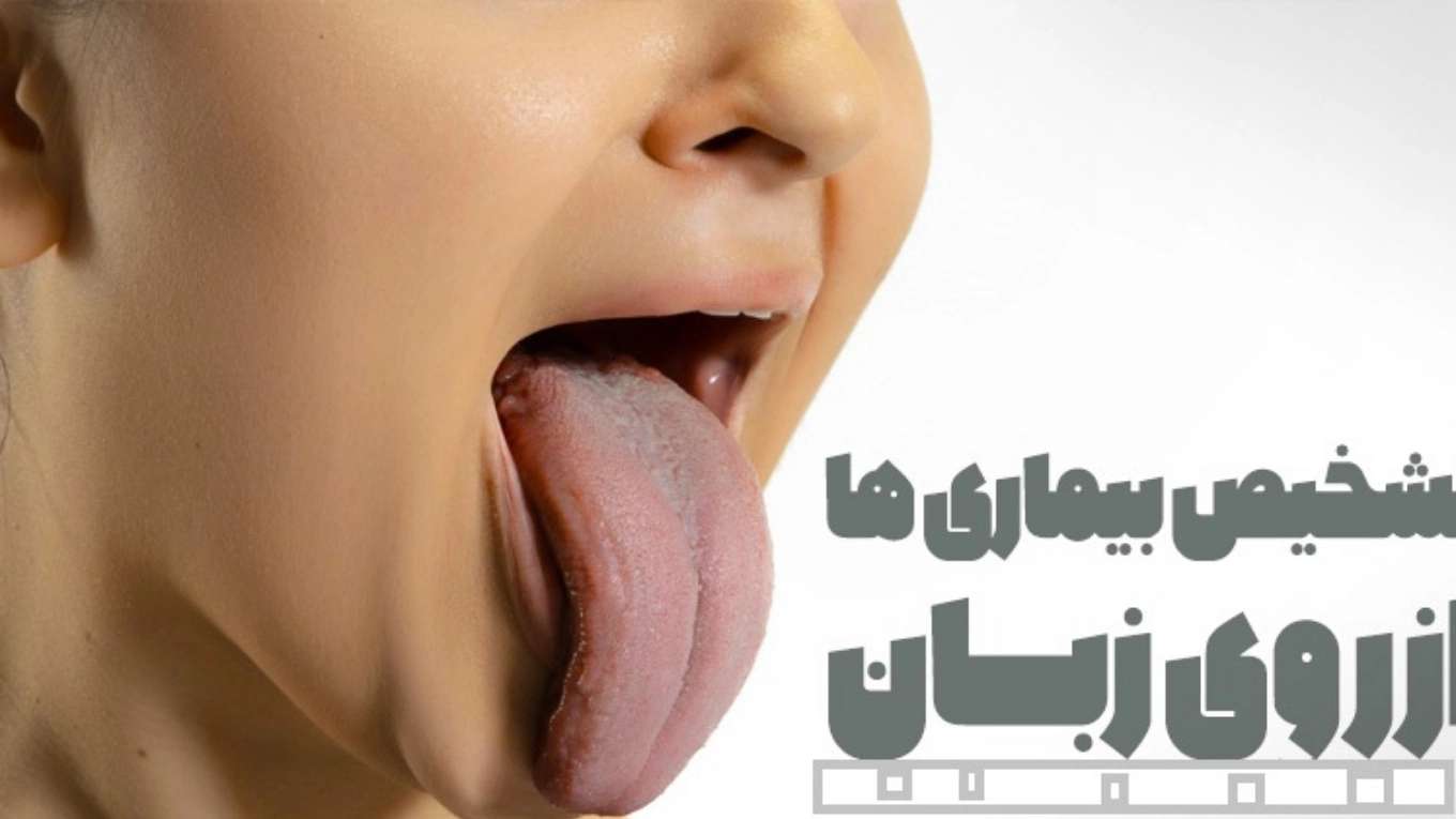Diagnosing the disease from the tongue