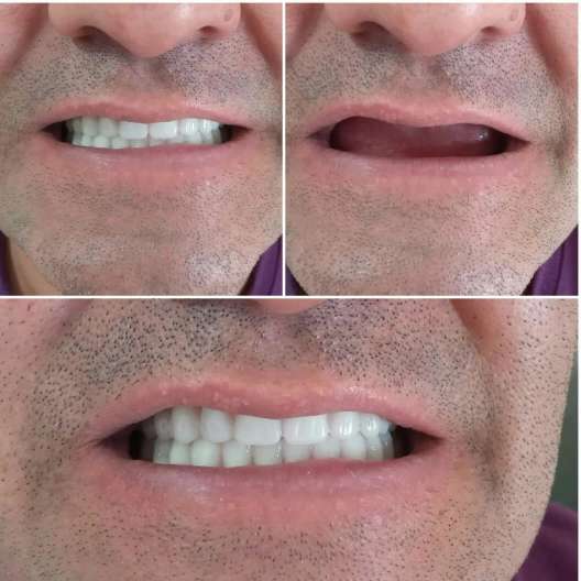 دندان مصنوعی و لابراتوار دندانسازی آرش منبری در سنندج