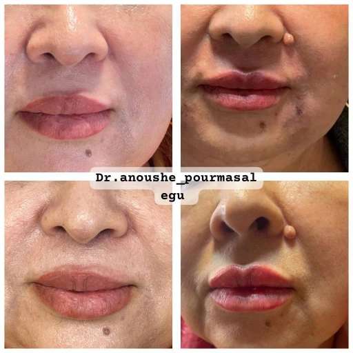 کلینیک زیبایی دکتر انوشه پور مسئله گو