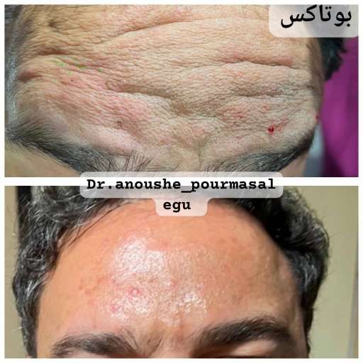 کلینیک زیبایی دکتر انوشه پور مسئله گو