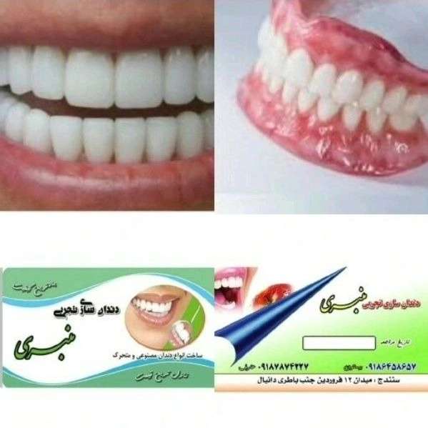 دندانسازی بیستون منبری