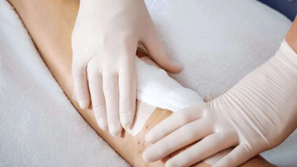 New wound and dressing expert
