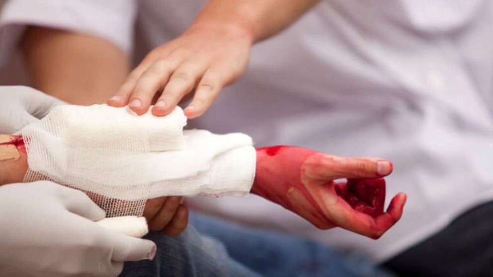 New wound and dressing expert