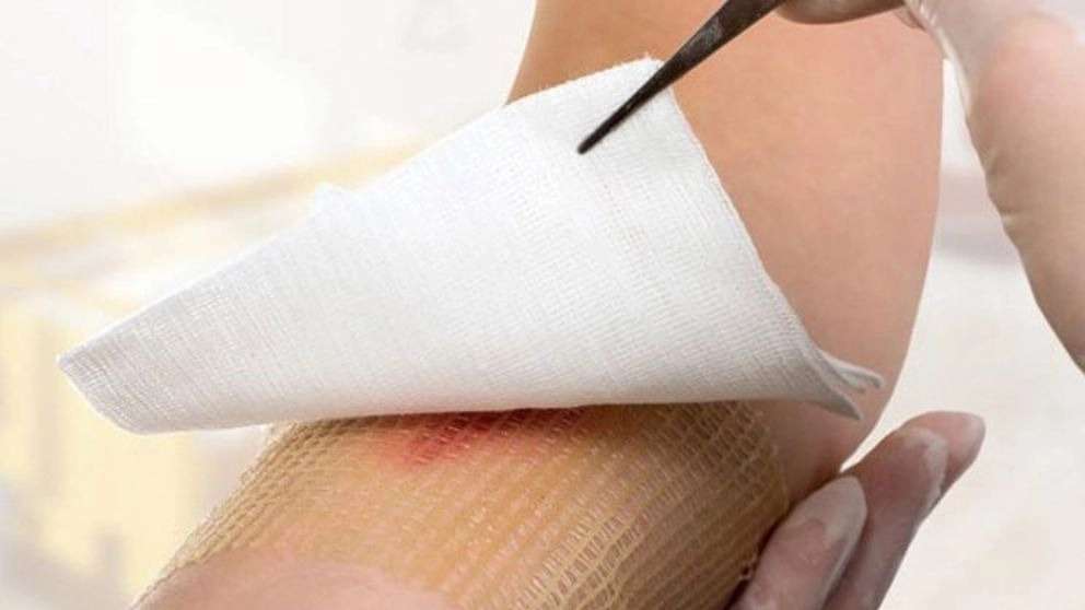 New wound and dressing expert
