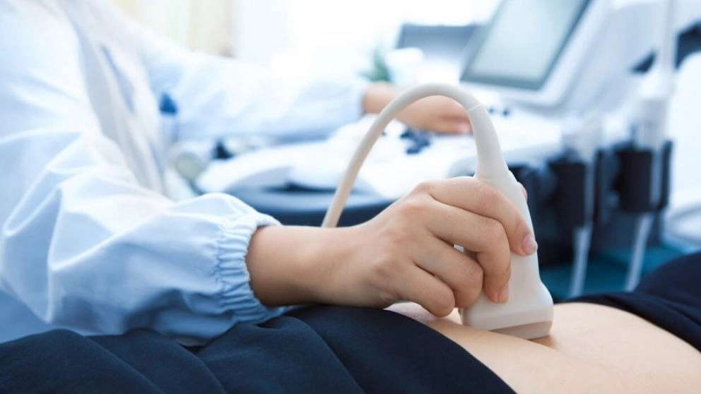 Three and four-dimensional color ultrasound