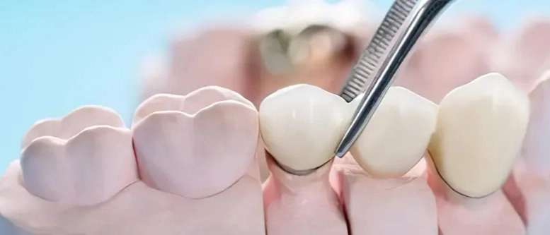 Nice Mousavi dentistry