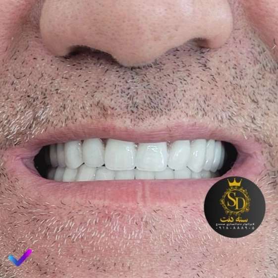 1710546883222.webp