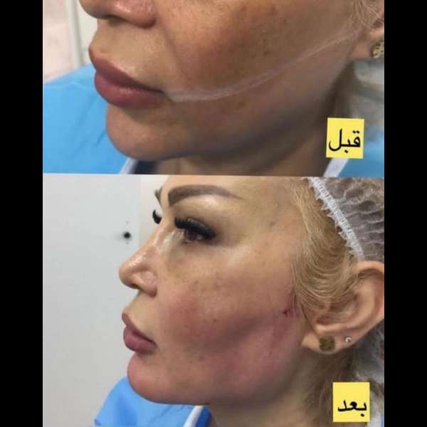 1710577502852.webp